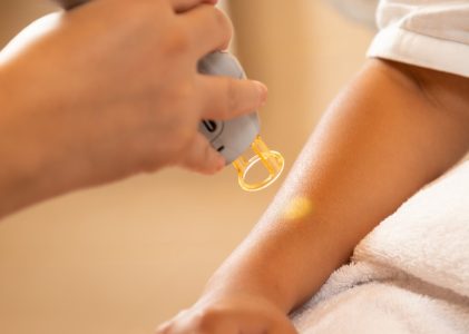 Ontdek de ultieme schoonheidservaring en gladde huid in Amsterdam Noord met laserontharing
