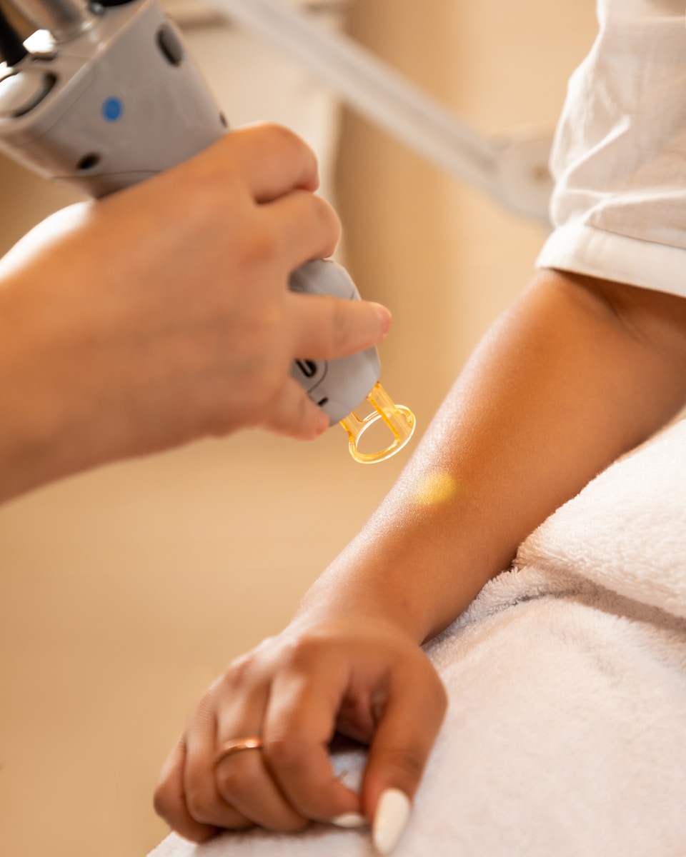 Ontdek de ultieme schoonheidservaring en gladde huid in Amsterdam Noord met laserontharing